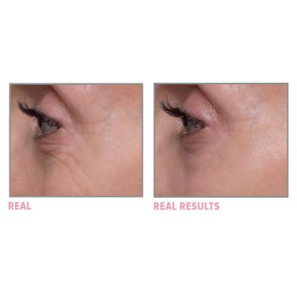 Bye Bye Under Eye Brightening Eye Cream for Dark Circles